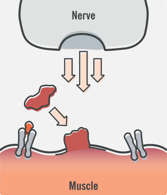 Diagram showing how C5 activates other complement proteins, which then directly attack your muscle cells