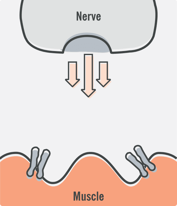 Diagram of a healthy neuromuscular junction