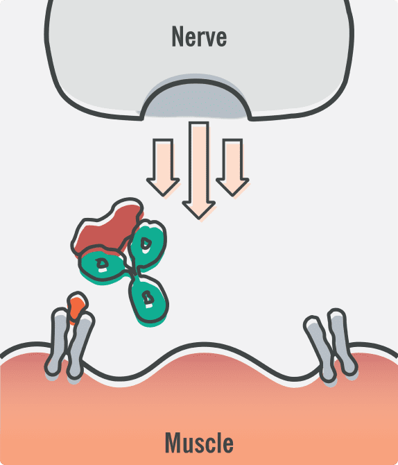 Diagram showing how ULTOMIRIS binds to and blocks complement protein C5